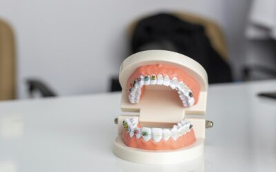 A Guide to the Different Types of Metal Braces