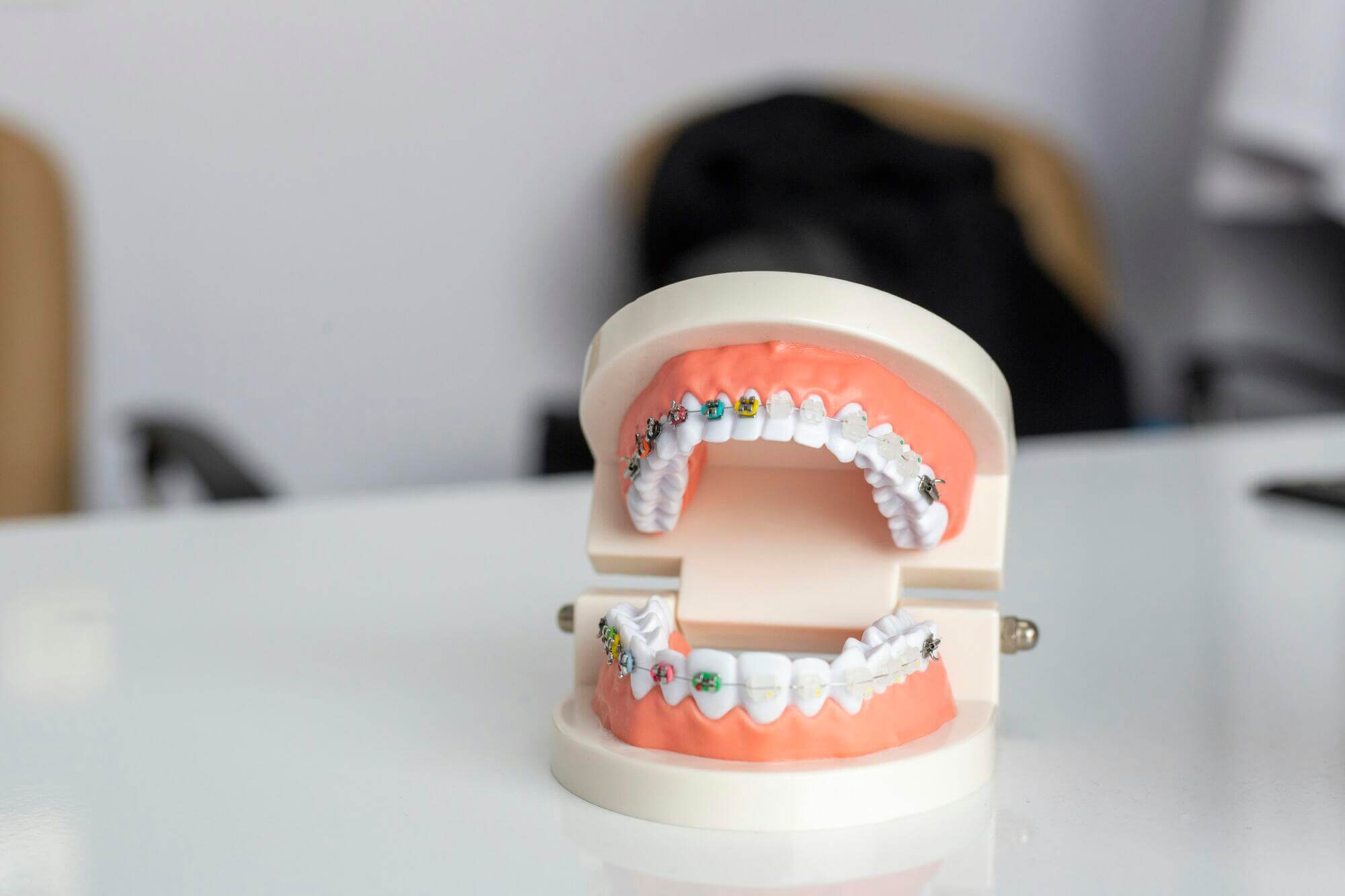 A Guide to the Different Types of Metal Braces